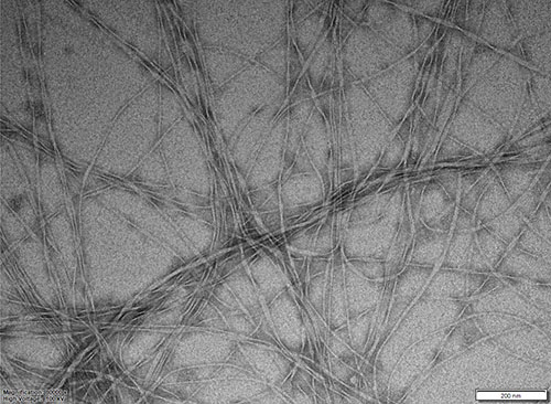 TEM image of hydrogel fibres